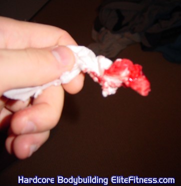 blood2.jpg