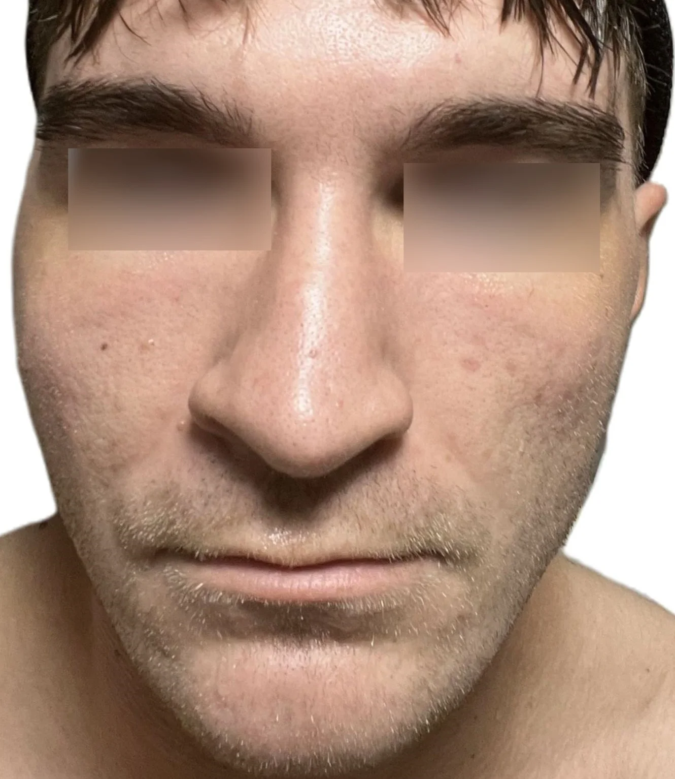 skin num1.webp
