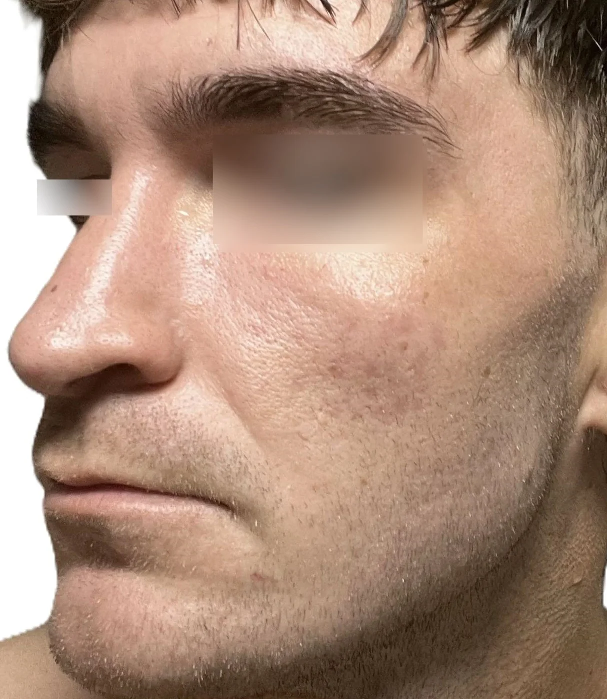 skin num2.webp