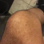 tarcbvmm.webp
