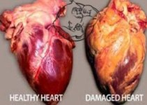 HEART-DISEASE.jpg