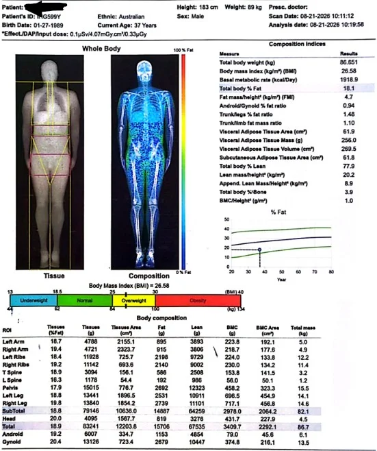 Dexa Aug 2026.webp