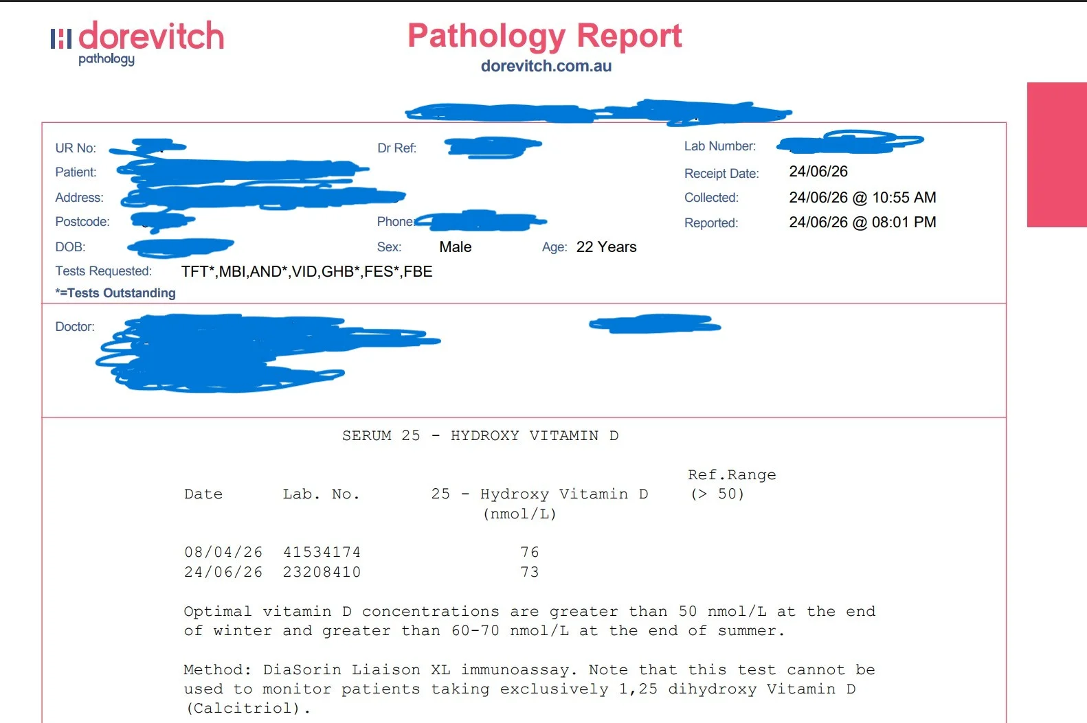 Vitamin D Testing .webp