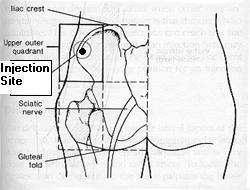 Steroids for sciatic nerve pain